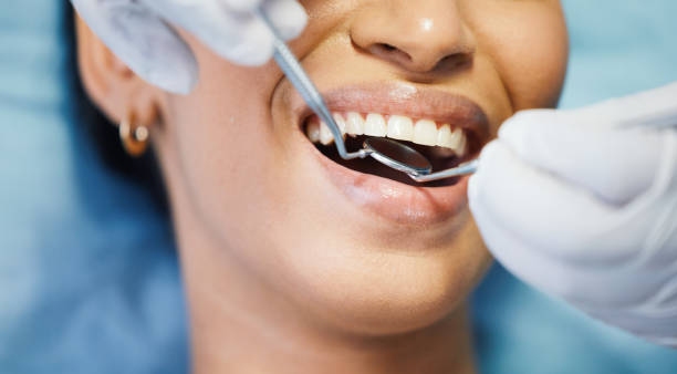 Best Emergency Dentist for Knocked-Out Tooth in Randallstown, MD