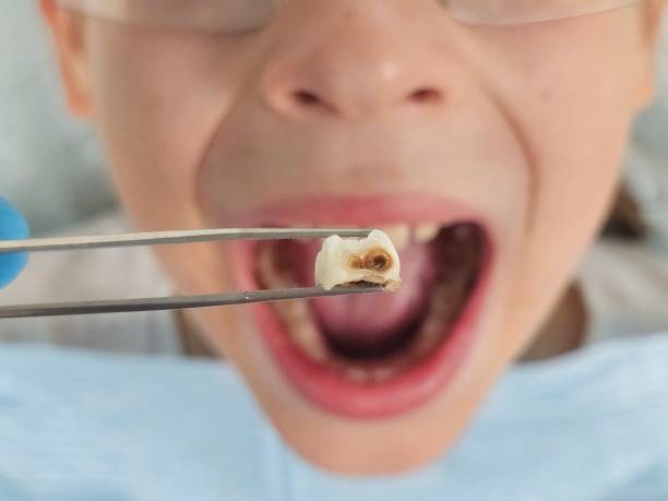 Best Pediatric Emergency Dentist in Randallstown, MD